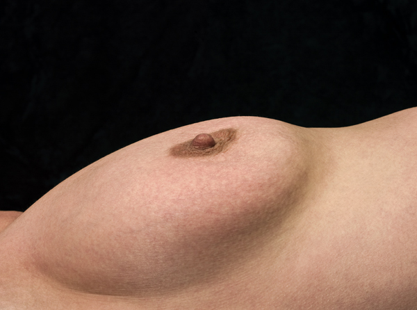 Download Breast - 2008 (600Wx446H)