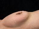 Breast - 2008 (600Wx446H) - Breast - 2008 - Phase I - Hassleblad  