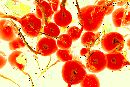  (1800Wx1200H) - Radish Power 